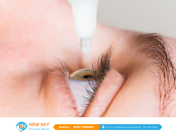 nhỏ nước mắt nhân tạo đúng cách
