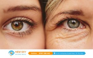 Lão hóa mắt đang dần trẻ hóa bởi nhiều nguyên nhân